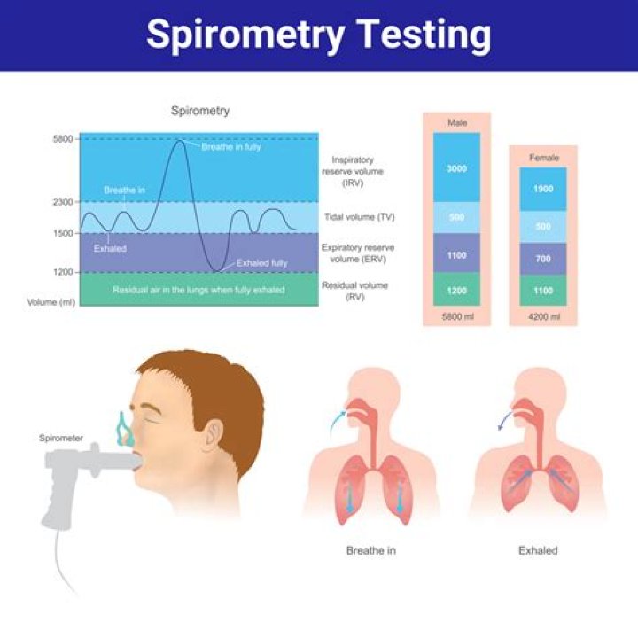 How much does Spirometry testing cost?